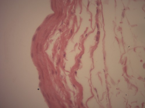 Qual o tecido epitelial de revestimento presente na imagem ?