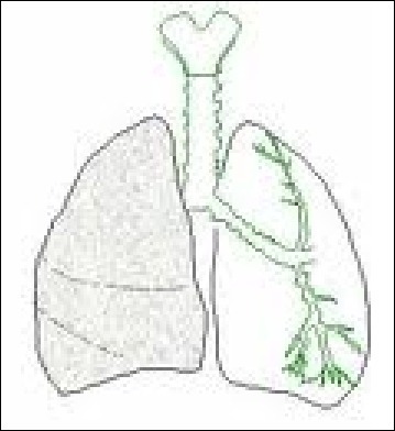 Comment se nomment les petites parties au bout des bronchioles, dans les poumons ?