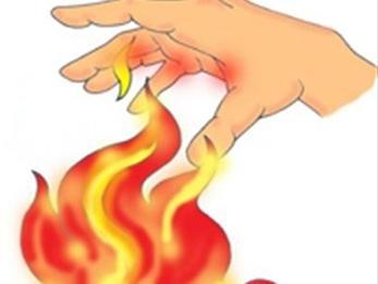 A queimadura é uma lesão produzida nos tecidos corporais no contato com fontes de calor, como radiação. Quando os tecidos são queimados, há uma perda de liquido para o seu interior a partir dos vasos sanguíneos causando inchaço.