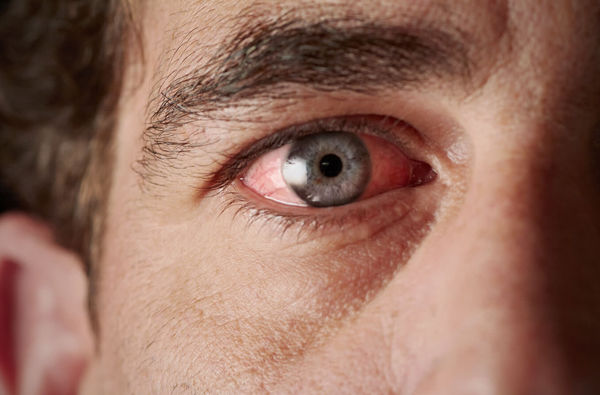 Avoir les yeux  ...