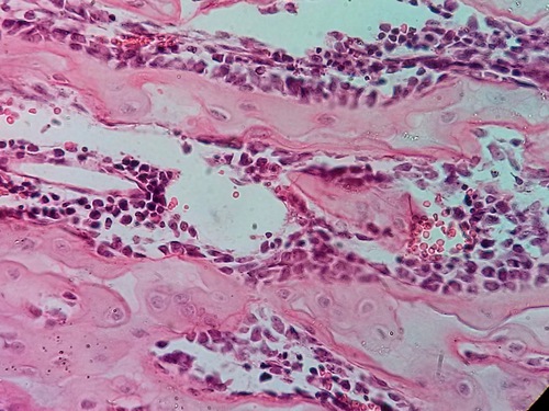 Quais células você ver nesse tecido ?