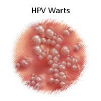 A infecção pelo vírus HPV, é um fator de risco para desenvolver o câncer de :