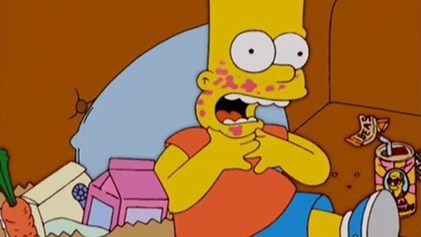 Bart est allergique aux anchois