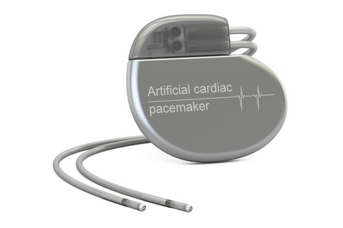 Le Pacemaker est un appareil qui sert à régler le rythme d’un organe. Lequel ?