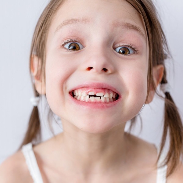 En général, quelles sont les premières dents de lait qui apparaissent ?