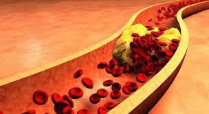 O colesterol mesmo visto muitas vezes como algo ruim, possui extrema importância para o organismo humano porque ele é: