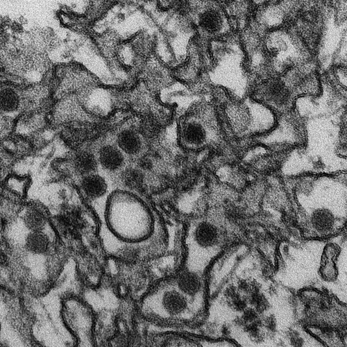 Where was virus Zika discovered for the first time ?