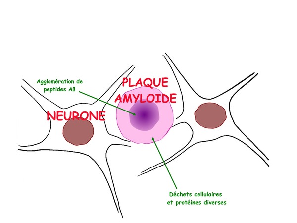 Les pistes principales sont de s'attaquer aux ......qui se forment entre les neurones durant la maladie et aux agrégats de protéines tau formant les dégénérescences neurofibrillaires à l'intérieur des neurones.