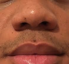Comment s'appelle ce nez ?