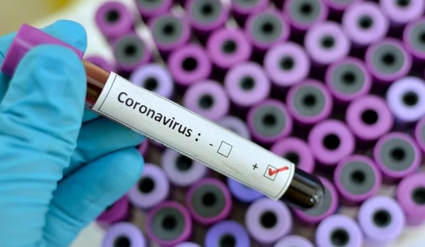 Como se prevenir do Novo Coronavírus (Covid-19)?