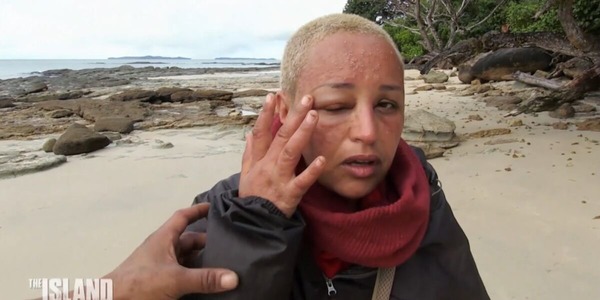 En 2018, quelle chanteuse s'est rasé la tête pour l'émission The Island ?