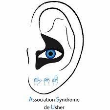 Trouble de la vision et de l'ouïe causé par la rétine, ce syndrome porte le nom d'un chanteur ?
