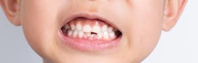 Les dents chez les marmots sont appelées comment ?