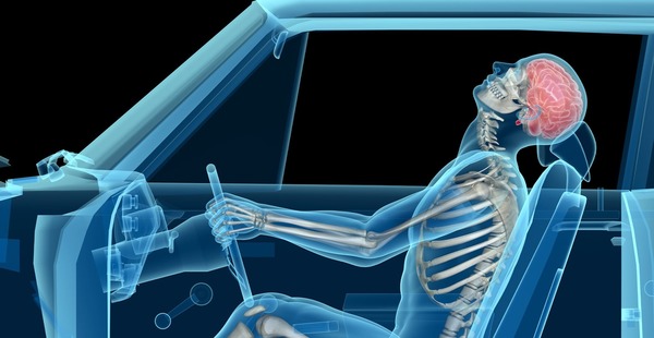 Lors d'un accident de voiture, on peut être victime du coup du....